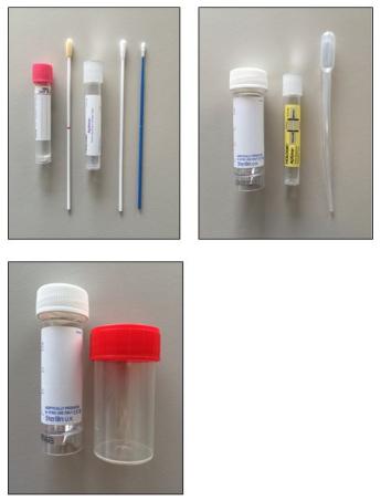 Onderzoekenwijzer MMB - Soa afnameset uitstrijk urine diverse containers