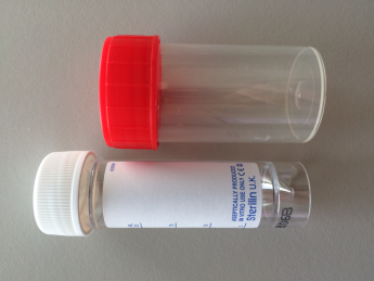 Onderzoekenwijzer MMB - Urinecontainer witte of rode dop