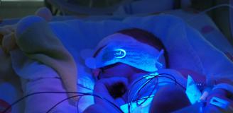 Baby onder de blauwe lamp krijgt fototherapie