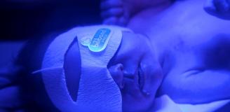 Een baby onder de blauwe lamp
