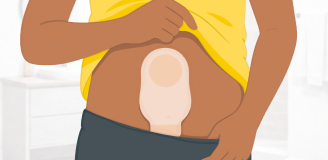 stoma zelf verzorgen