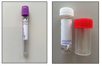 Onderzoekenwijzer MMB - Bloedbuis edta urinecontainer rood wit