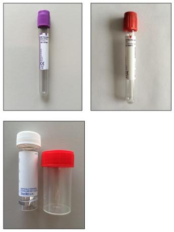 Onderzoekenwijzer MMB - bloedbuis paars rood steriele containers
