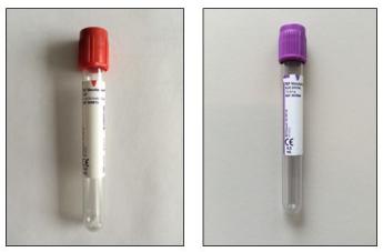 Onderzoekenwijzer MMB - bloedbuis stolbloed en bloedbuis edta bloed