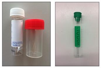 Onderzoekenwijzer MMB - Diverse steriele containers en liquorbuis groene dop