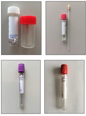 Onderzoekenwijzer MMB - Eswab roze dop liquorbuis bloed rood paars divers containers