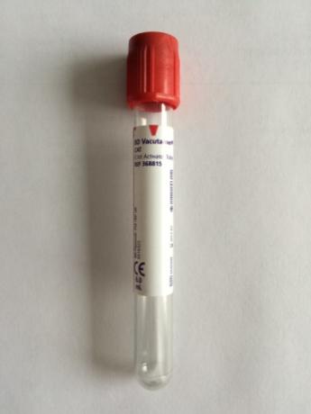 Onderzoekenwijzer MMB - Bloedbuis voor stolbloed 6.0 ml rode dop