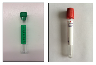 Onderzoekenwijzer MMB - Liquorbuis groene dop en bloedbuis voor stolbloed