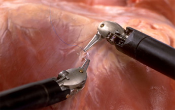 Operatiecentrum - robotchirurgie handeling