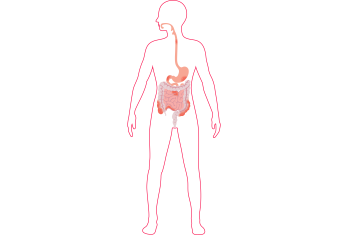 De afbeelding laat zien waar de ontstekingen bij crohn kunnen ontstaan in het maagdarmkanaal. 