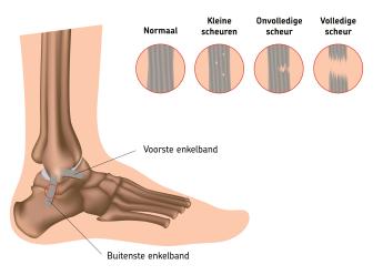 Anatomie voet en enkelbanden