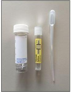 SOA Aptima urine