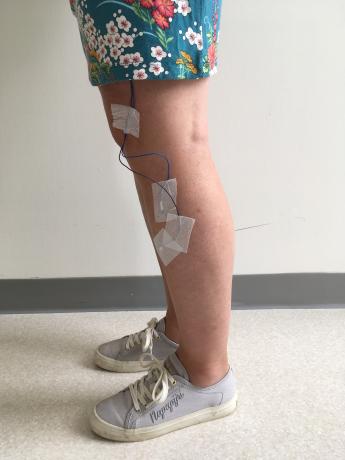 Foto elektroden slaaponderzoek op been
