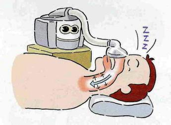 CPAP- apparaat
