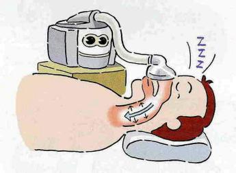 CPAP- apparaat
