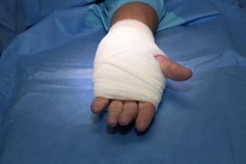 Hier ziet u het verband dat u na de operatie om uw hand krijgt.