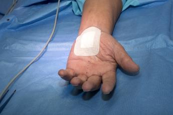 Hier ziet u de pleister die u na uw operatie op uw hand krijgt.
