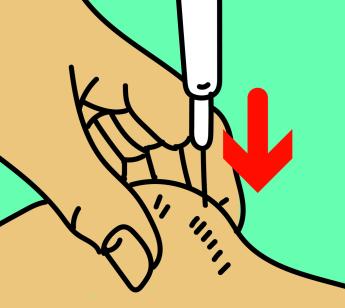 Afbeelding met huidplooi tussen duim en wijsvinger en de spuit