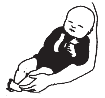 Op deze afbeelding ziet u de juiste positie van het armpje van uw kindje