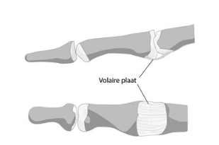 Volaire plaat