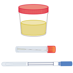 Urine test