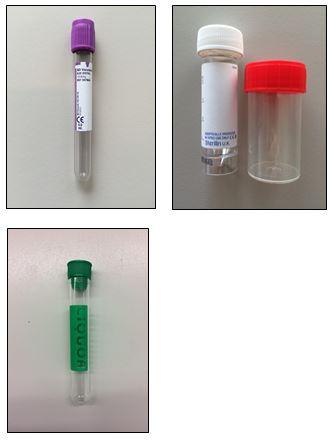 Onderzoekenwijzer MMB - bloedbuis edta urinecontainer rood wit liquorbuis