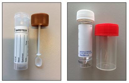 Onderzoekenwijzer MMB - Fecescontainer diverse steriele containers