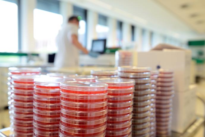 Petrischaaltjes in het laboratorium Medische Microbiologie