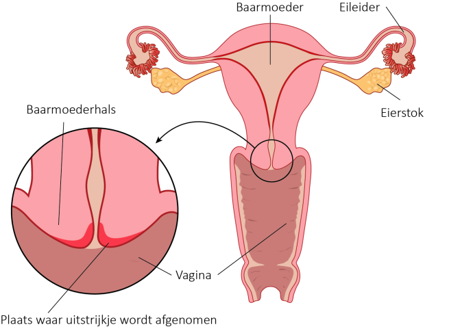 afbeelding van baarmoeder en de plaatst waar het uitstrijkje wordt afgenomen