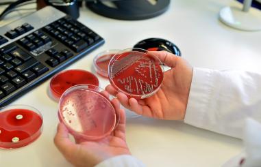 afdelingen laboratorium medische microbiologie testschaaltjes uitslag