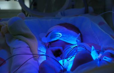 Baby onder de blauwe lamp krijgt fototherapie