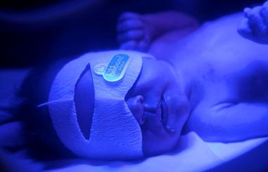Een baby onder de blauwe lamp