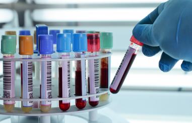 Onderzoek bloed laboratorium